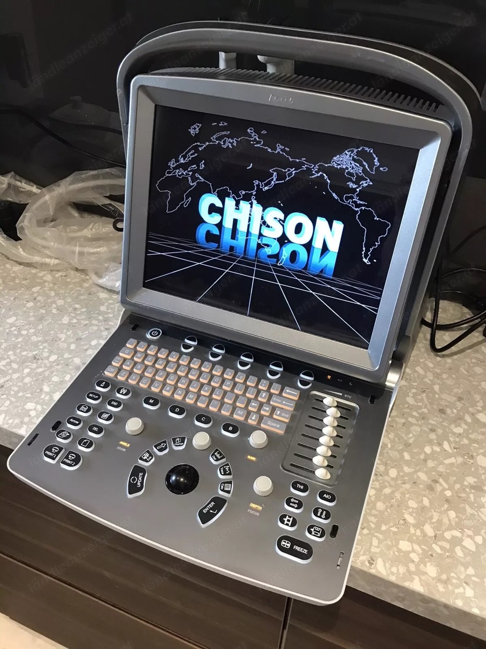 Chison Eco 5 Mobiles Ultraschall Portable Ultrasound