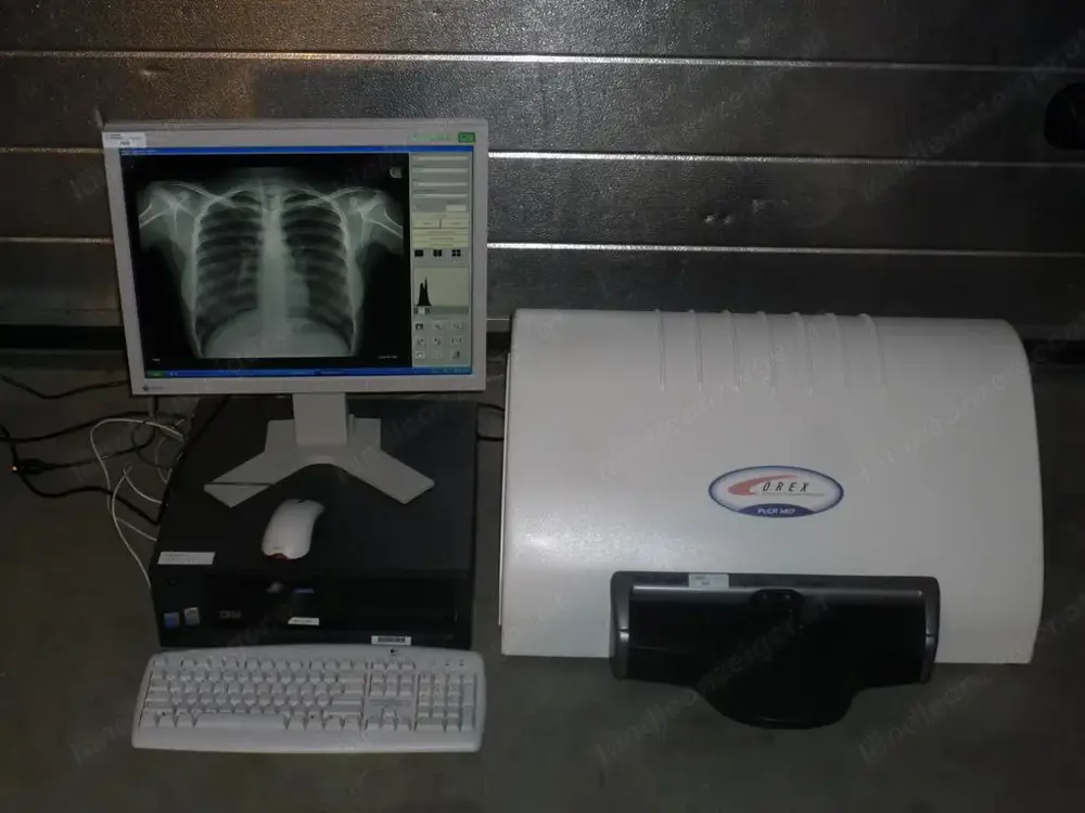 Kodak Orex PcCR 1417 ACL4 Digital X-ray Röntgen Imaging 