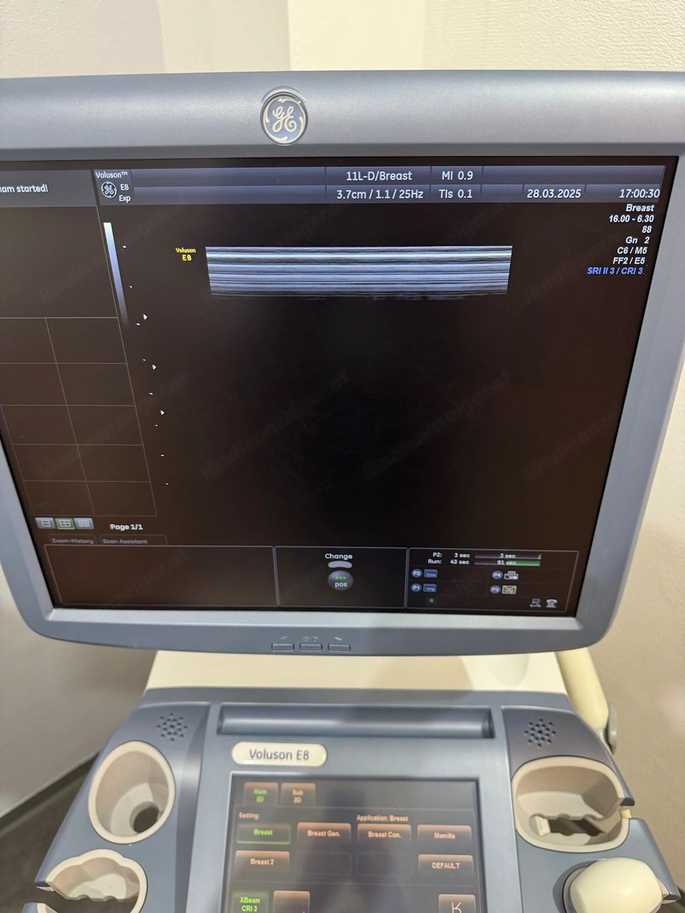 GE Voluson E8 Ultraschallgerät Gynäkologie