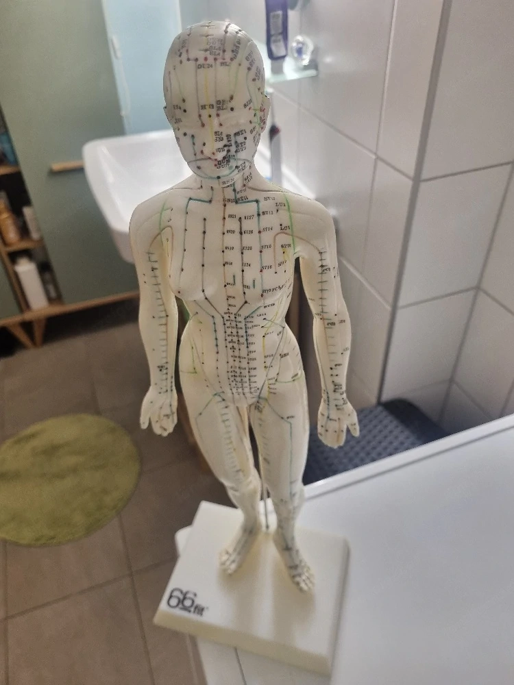 Akupunktur 
