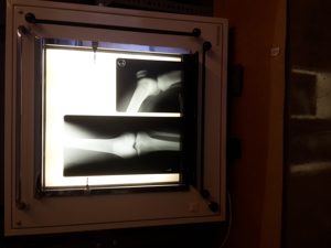 Röntgenbildbetrachter von Planilux Bild 13