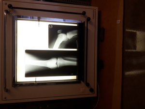Röntgenbildbetrachter von Planilux Bild 8