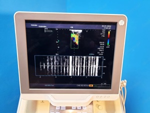 Toshiba Xario SSA-660A Ultraschallgerät Bild 2