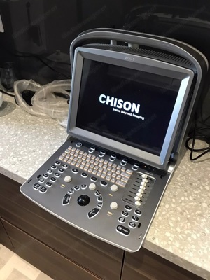 Chison Eco 5 Mobiles Ultraschall Portable Ultrasound Bild 2