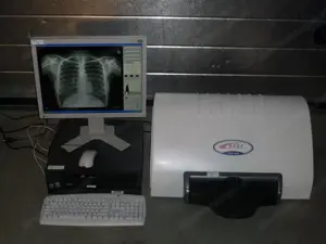 Kodak Orex PcCR 1417 ACL4 Digital X-ray Röntgen Imaging 