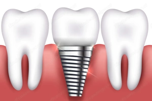 Ungarische Zahnkliniken Lustenau und Bludenz Bild 4