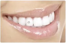 Zahnschmucksteine weiß + blau  Bild 4