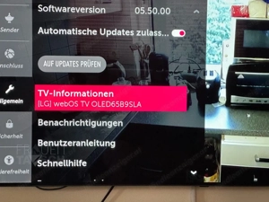 LG Oled 65 Zoll Bild 2