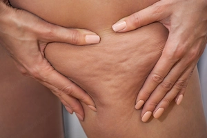 Forme deine Körper mit Slimyonik Bodystyler Bild 7