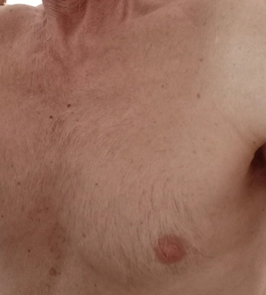 Verwöhnmassage von reifen Mann nur! Für Damen liebe Unbekannte geniesse eine kleine Auszeit mit mir 